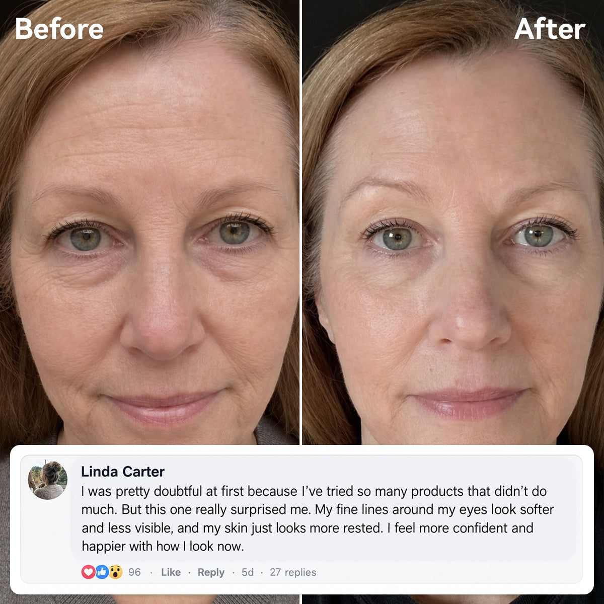 ✨Trusted-by-over-50-000-women✨FINE LINE SOFTENING Perfect Skin in 3 Minutes