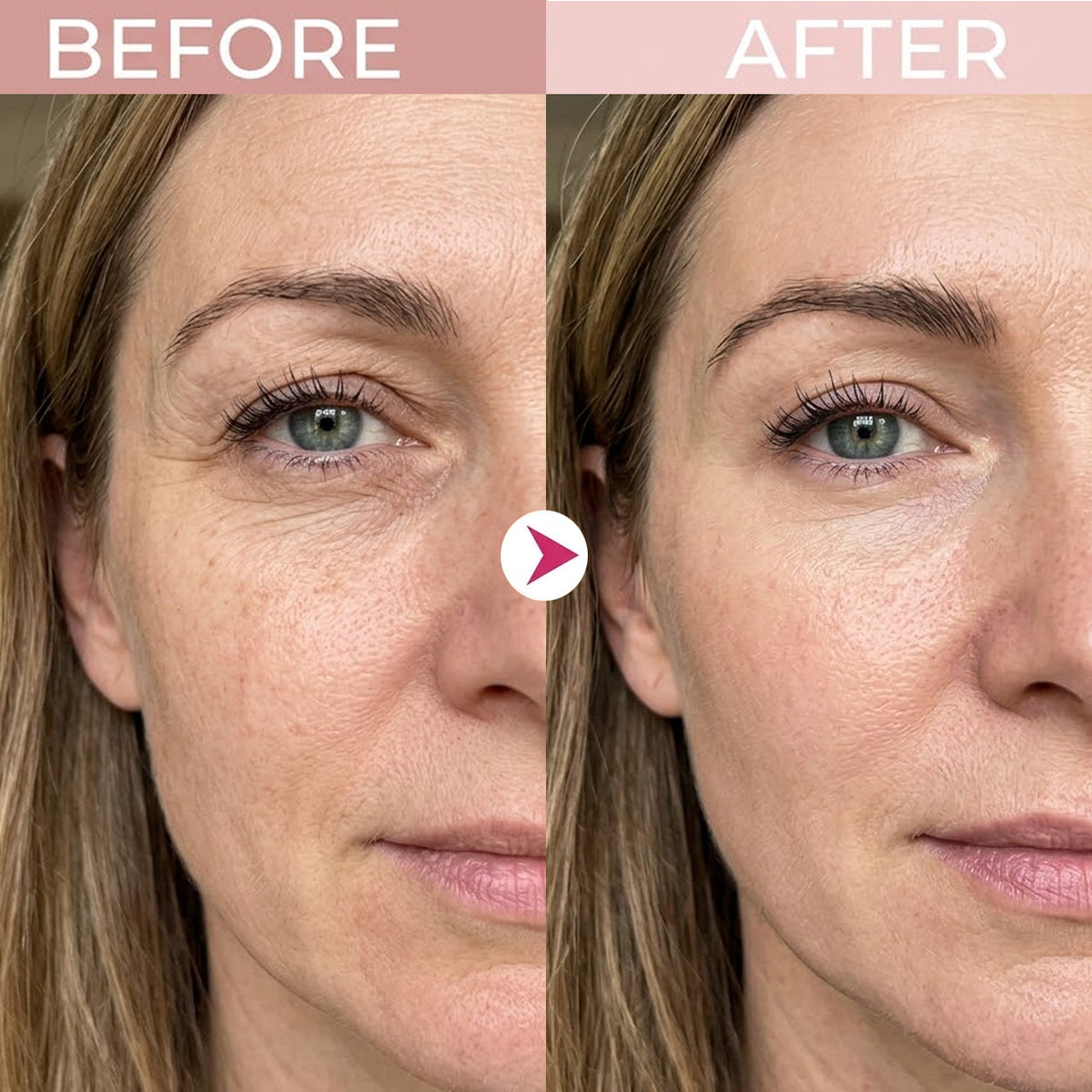 💖Trusted-by-over-50-000-women✨ Eye Renewal Crème