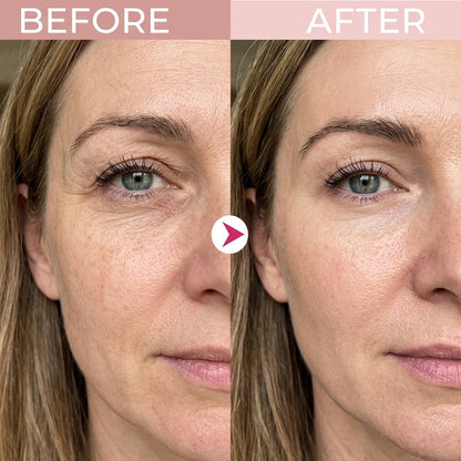 💖Trusted-by-over-50-000-women✨ Eye Renewal Crème