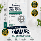✨✨Insideefy®2-in-1 Microneedle & Hydrocolloid Patch🍀| Removes Raised Moles, Acne, Flat Warts & Skin Tags | Helps Improve Wrinkles, Scars & Blemishes | Invisible Patches for Face & Body