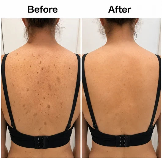 💖Trusted-by-over-50-000-women✨Smooth & Even Glycolic Body Stick