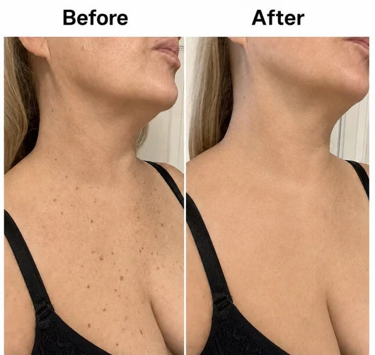 💖Trusted-by-over-50-000-women✨Smooth & Even Glycolic Body Stick