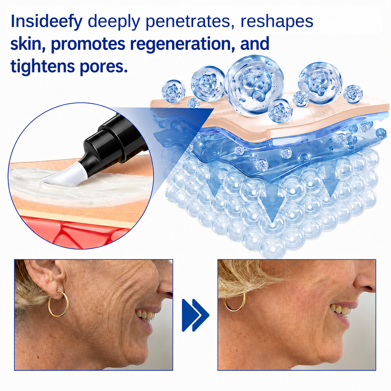 🥈🎁UK HOT SALE Insideefy® PDRN Anti-Wrinkle Shot – Lift & Firming Cream