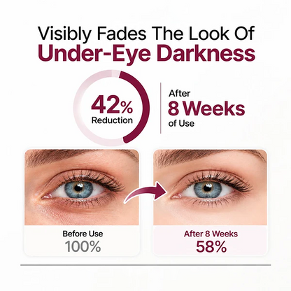 💖Trusted-by-over-50-000-women✨ Eye Renewal Crème