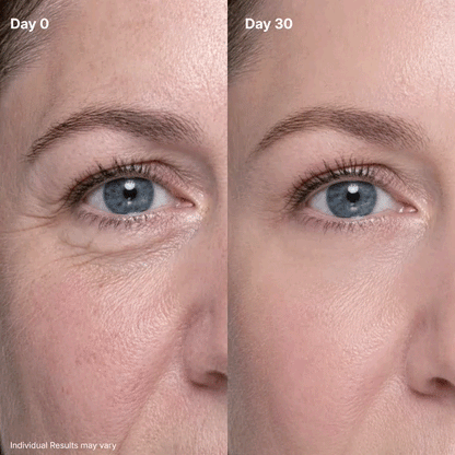 💖Trusted-by-over-50-000-women✨ Eye Renewal Crème